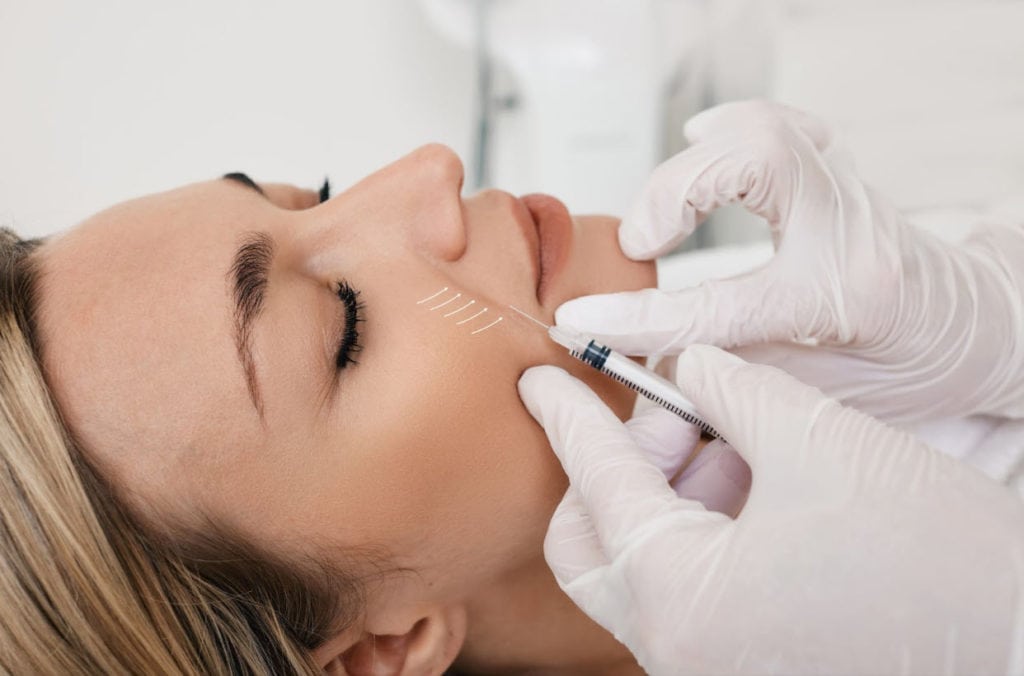 A professional administering dermal filler injections to a patient's smile lines, showcasing the precision and effectiveness of the best fillers for smile lines in achieving a smoother and more youthful appearance.