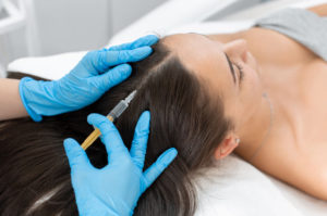 A professional performing PRP therapy on a patient’s scalp, demonstrating how PRP works for hair loss by stimulating hair growth and improving follicle health